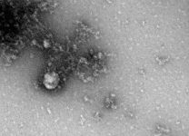 Ученые объяснили, почему "британский" штамм коронавируса такой заразный